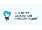 имплантация под ключ Москва